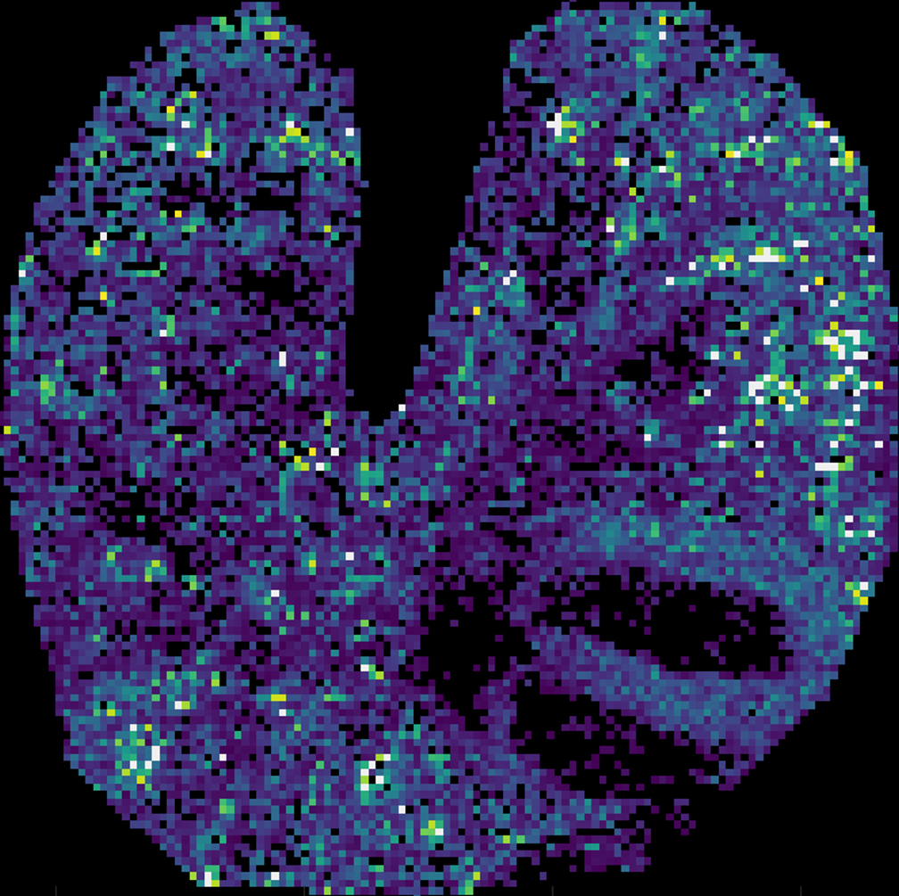 Ambient Ionization for Tissue Imaging